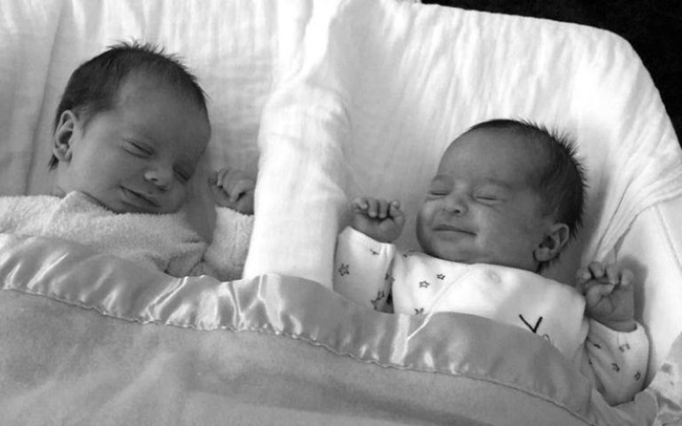 cervical cerclage twins at 21 weeks