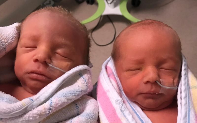 Laser ablation surgery success story Twin To Twin Transfusion Syndrome