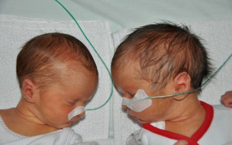 twins special care