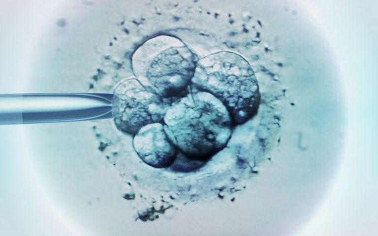 IVF process and twins