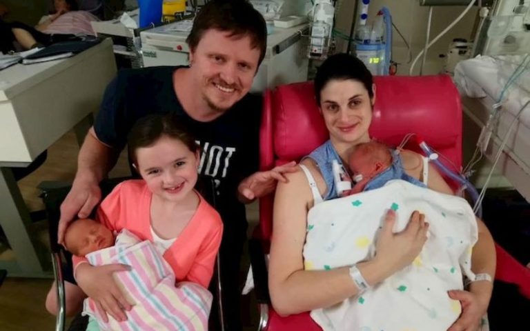 open heart surgery in twins