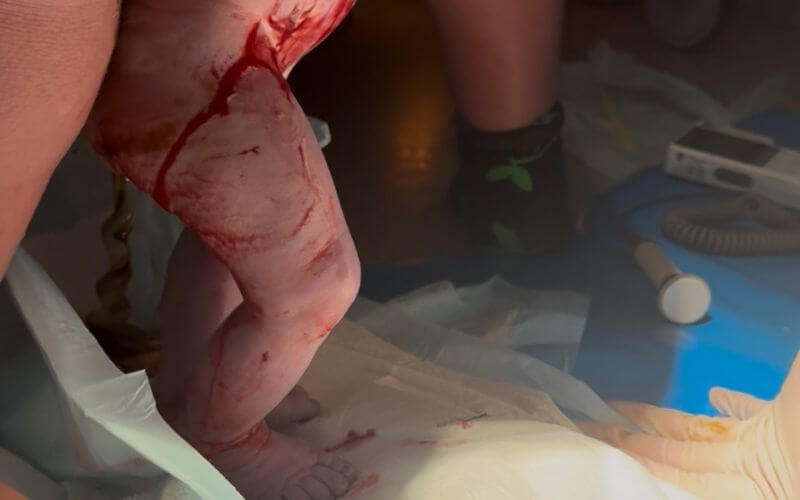 41 weeks pregnant with twins